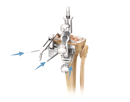 Knee Joint