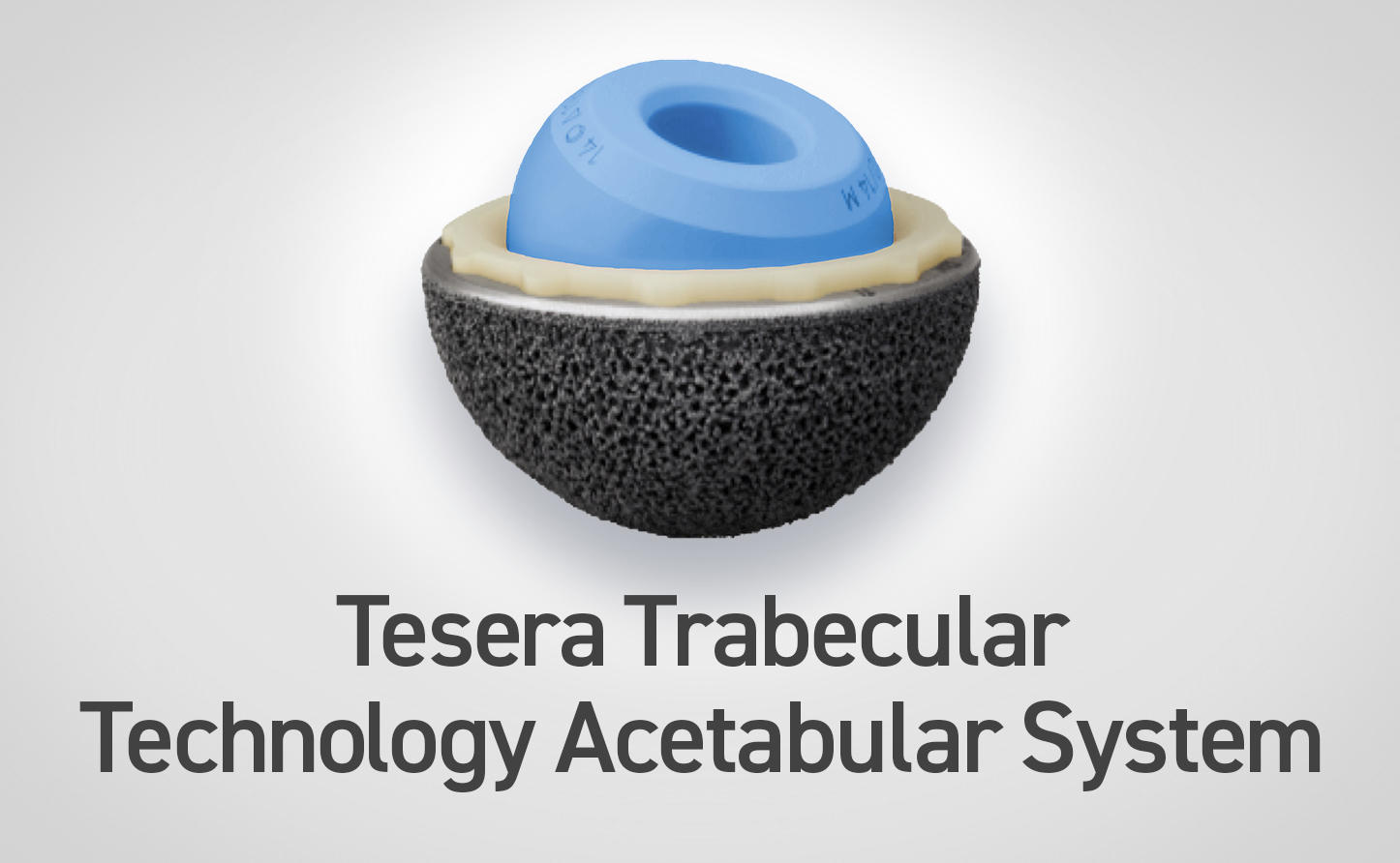 Tesera Trabecular Technology Acetabular System